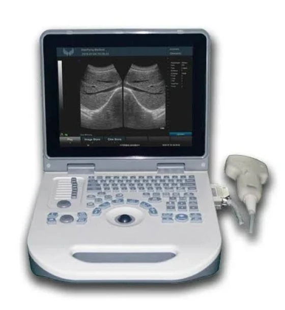 XF30A Portable Ultrasound جهاز الأشعة التلفزيونية السونار XF30A