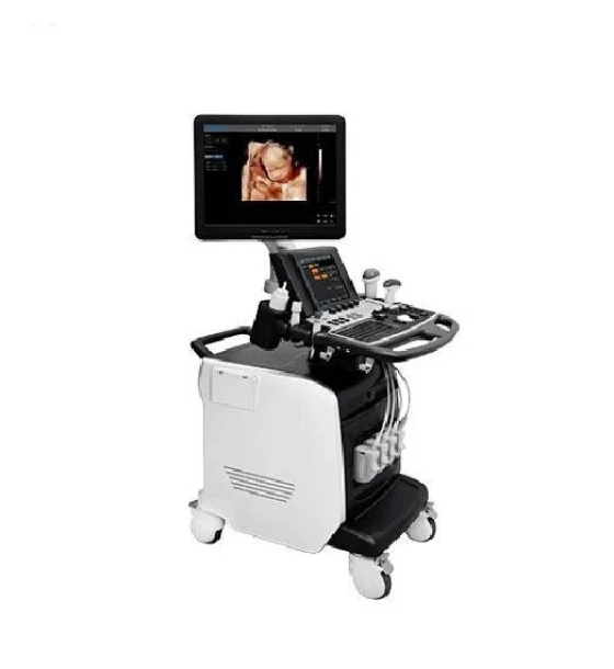 جهاز الموجات فوق الصوتية ألتراساوند ملون Chison i6 (Trolley Color Doppler Ultrasound Chison i6)