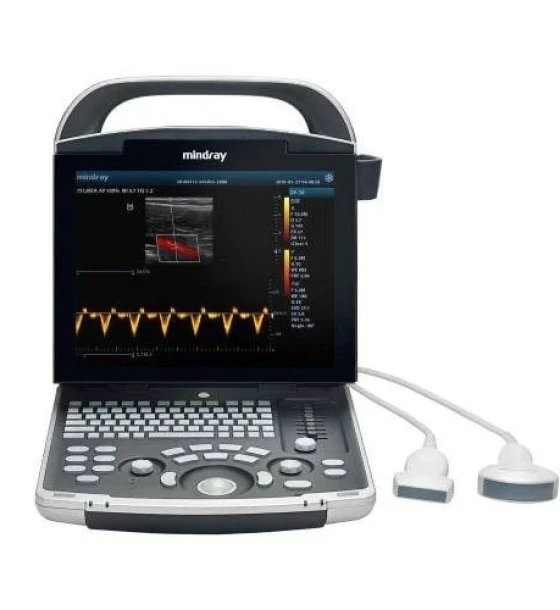جهاز الموجات فوق الصوتية المحمول Mindray DP-30 (Portable Full Digital Ultrasound Mindray DP-30