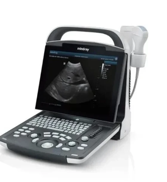 جهاز الموجات فوق الصوتية المحمول Mindray DP-20 (Portable Full Digital Ultrasound Mindray DP-20)