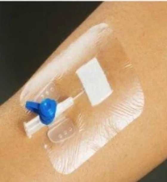 بلاستر شفاف لتثبيت الكانيولا (IV Cannula Fixator)