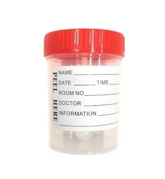 علبة جمع عينات البول معقمة 60 مل (Urine Container)