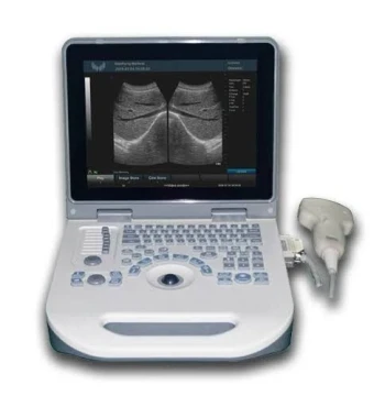 XF30A Portable Ultrasound جهاز الأشعة التلفزيونية السونار XF30A