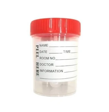علبة جمع عينات البول معقمة 60 مل (Urine Container)